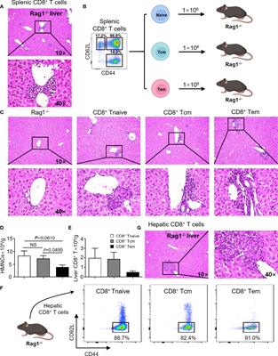 Single-Cell Characterization of Hepatic CD8+ T Cells in a Murine Model of Primary Biliary Cholangitis